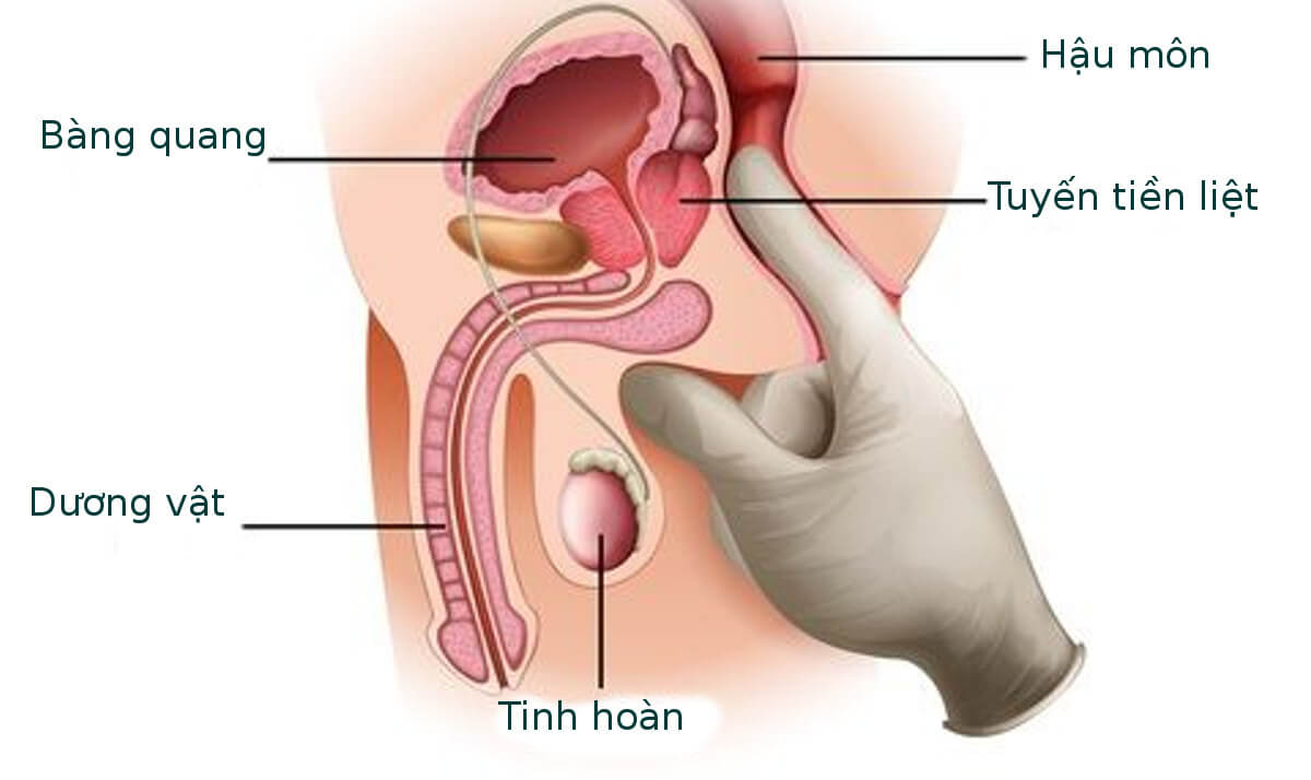 Tuyến tiền liệt là gì? Cấu tạo và một số bệnh lý thường gặp phổ biến