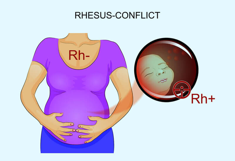 Nhóm máu Rh là gì? Lý do khi mang thai phải xét nghiệm nhóm máu Rh?