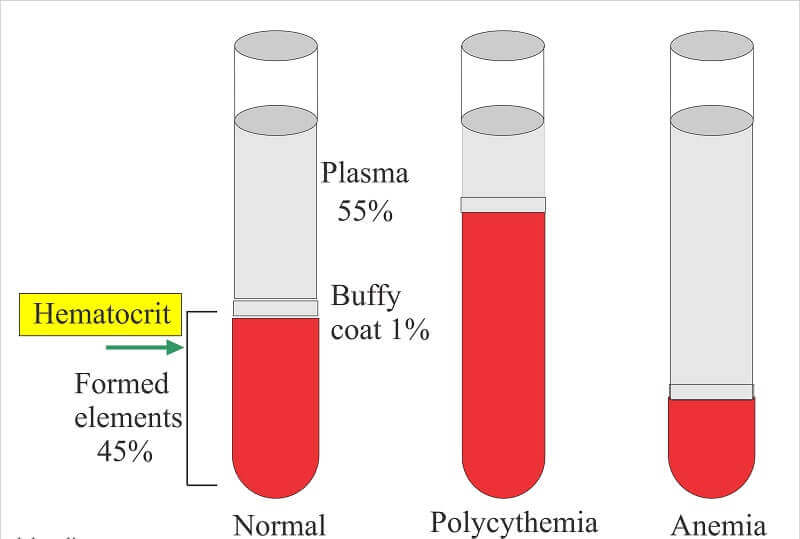 Hematocrit là gì? Đóng vai trò như thế nào trong xét nghiệm máu